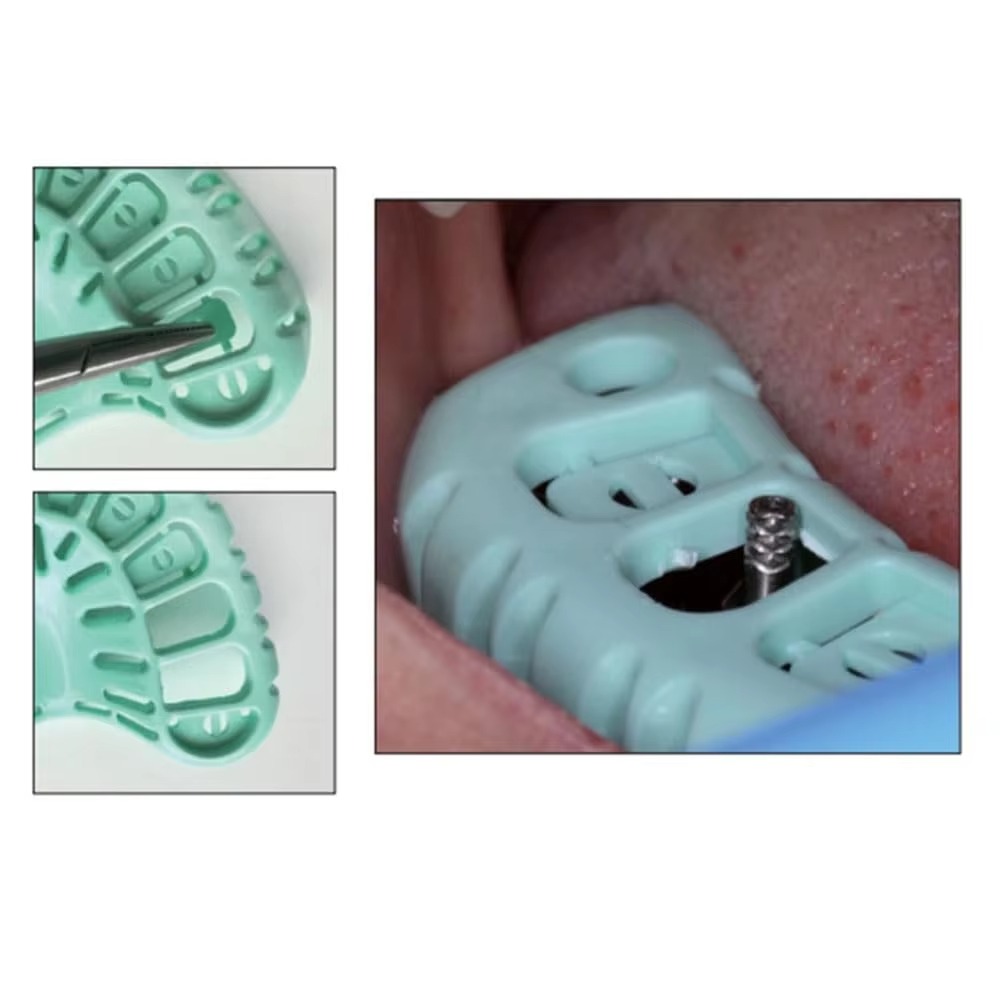 FULAIGE 6 Adet/Set Tek Kullanı - Dental Impression Material Kit incelemesi ve fiyatı