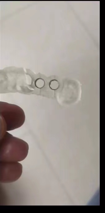 Reçine Diş 3D Yazıcı Dikim Kıl - Dental 3D Printer Resin incelemesi ve fiyatı