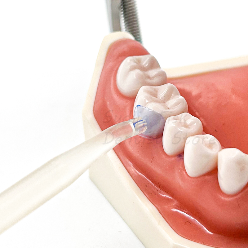 100 adet/takım Diş Matris Mavi - Dental Impression Material Kit incelemesi ve fiyatı