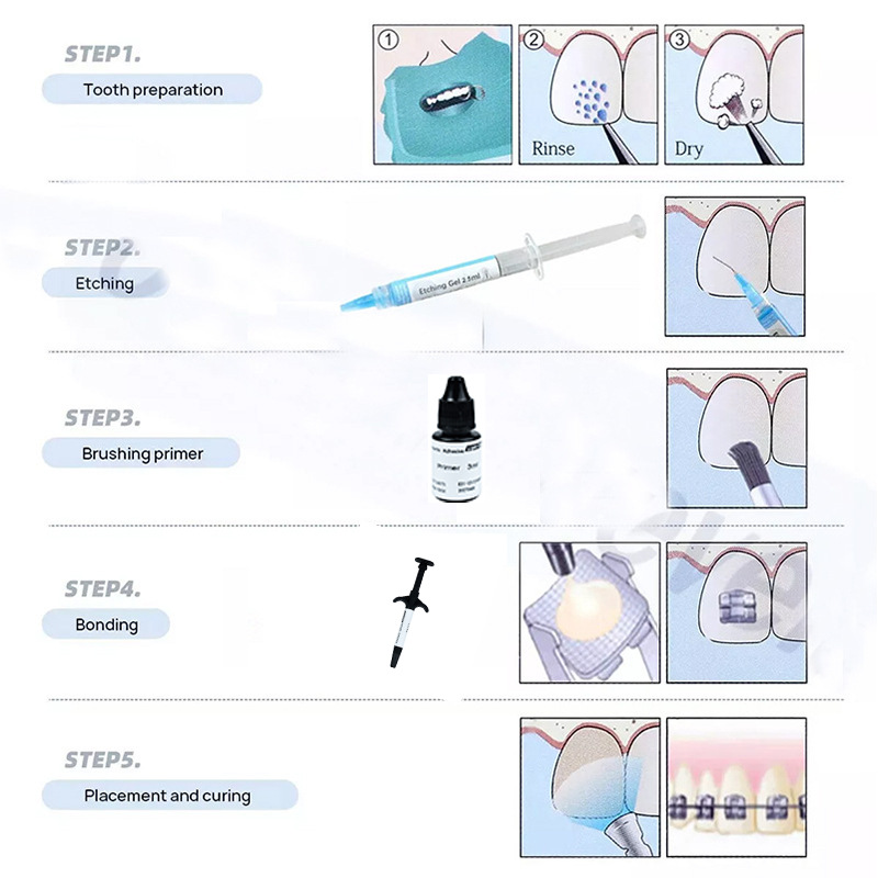 Diş Hekimliği Işıkla Sertleşen - Dental Impression Material Kit incelemesi ve fiyatı